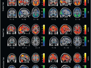 What is the test-retest reliability of common task-fMRI measures? New empirical evidence and a meta-analysis