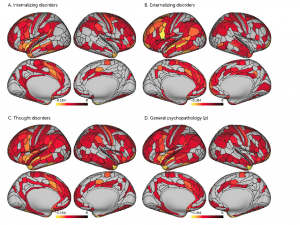 Pervasively thinner neocortex as a transdiagnostic feature of general psychopathology